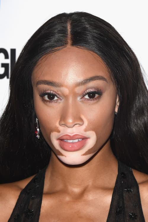 Winnie Harlow headshot